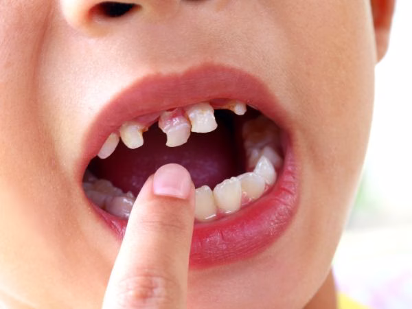 urgencia dental infantil